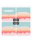 Точечные патчи от прыщей A'PIEU Madecassoside Needle Spot Patch - 10 шт
