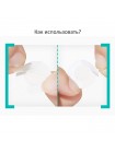 Точечные патчи от прыщей A'PIEU Madecassoside Needle Spot Patch - 10 шт