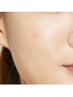 Маска-патч от прыщей COSRX Acne Pimple Master Patch 24 шт Маска-патч от прыщей COSRX Acne Pimple Master Patch 24 шт