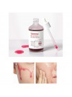 Гликолевая пилинг-сыворотка ESTHETIC HOUSE Toxheal Red Glycolic Peeling Serum 100мл