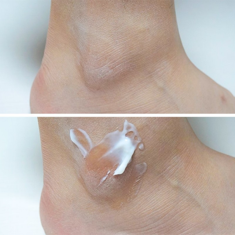 Бальзам-пилинг для кожи ступней KOELF Foot Care Peeling Balm - 40 гр.