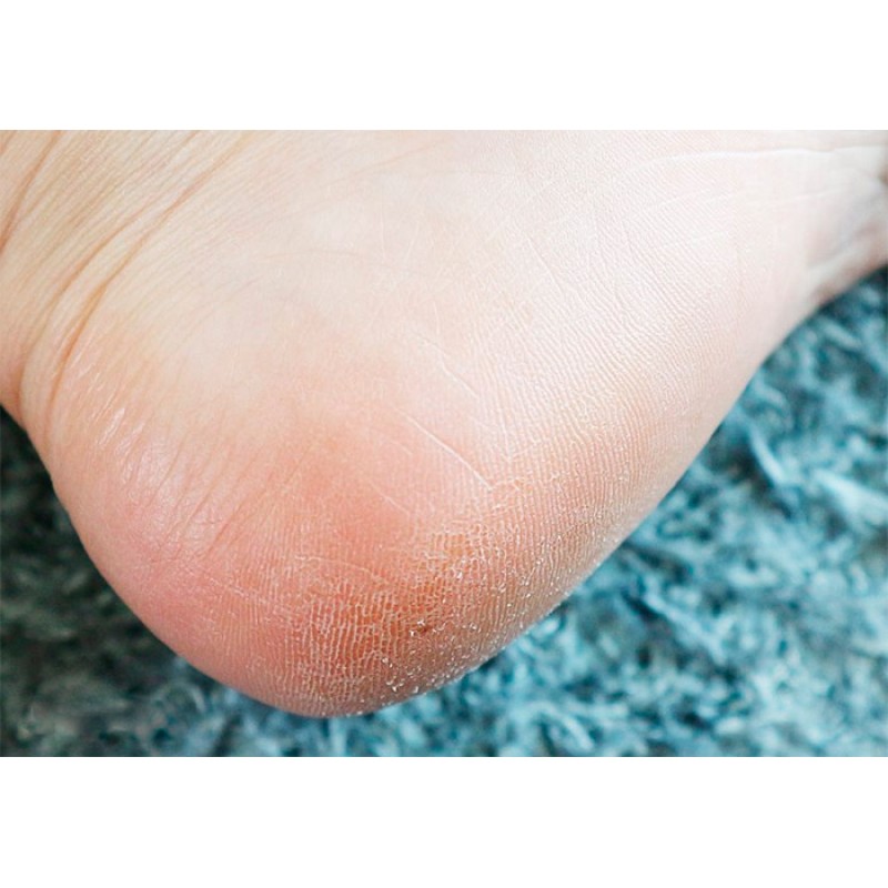 Бальзам-пилинг для кожи ступней KOELF Foot Care Peeling Balm - 40 гр.