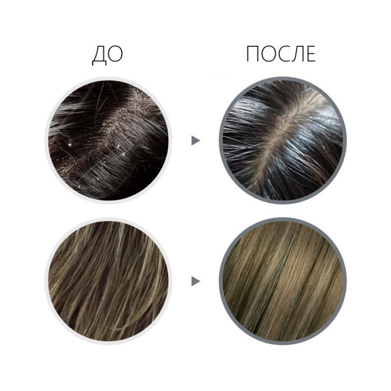 Шампунь против перхоти LADOR Dandruff Defense Shampoo - 530 мл
