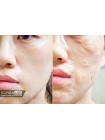 Лифтинг-маска для упругости кожи SCINIC Skin Tight Banding Pack - 70ml