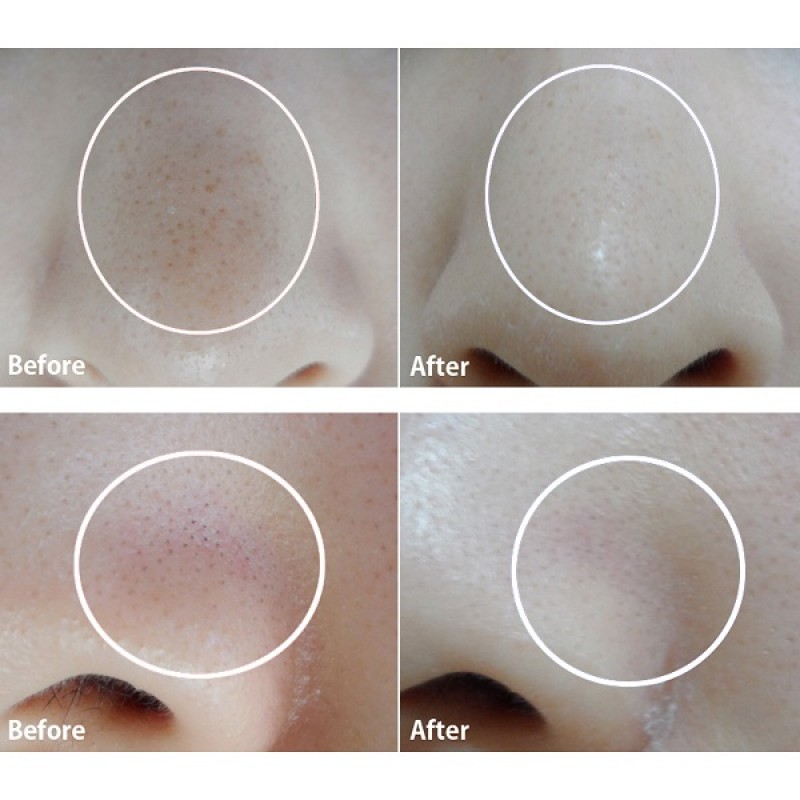 Пластырь(патч) для носа от черных точек TONY MOLY Egg Pore Nose