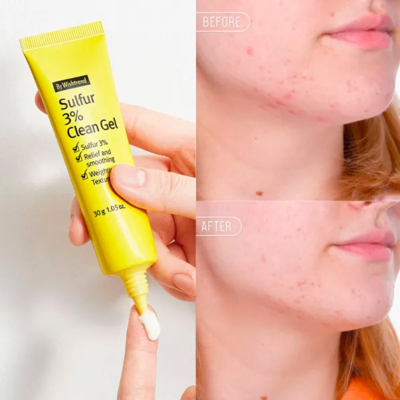 Локальный гель против акне с серой By Wishtrend Sulfur 3 Clean Gel 30мл
