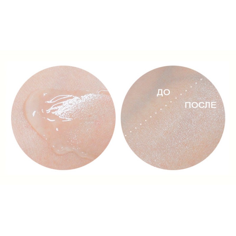 Увлажняющий крем для проблемной кожи CIRACLE Anti-Blemish Aqua Cream - 50 мл