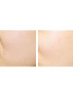 Сыворотка для сужения пор CIRACLE Pore Control Tightening Serum - 30 мл