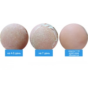 Пилинг-носочки для педикюра с персиком FRUDIA My Orchard Peach Foot Peeling Mask 40 гр