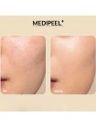 Лифтинг-эссенция MEDI-PEEL Peptide 9 Golden Camellia Wrinkle Essence 50 мл