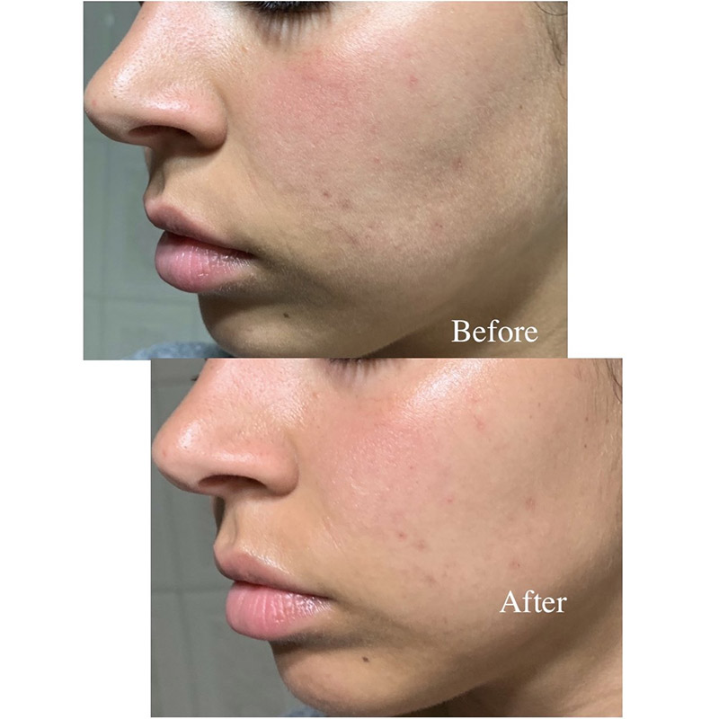 Балансирующий гель для лица PYUNKANG YUL Balancing Gel 60/100 мл