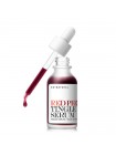 Кислотная сыворотка с тингл-эффектом SO NATURAL Red Peel Tingle Serum - 30 мл Кислотная сыворотка с тингл-эффектом SO NATURAL Red Peel Tingle Serum - 30 мл