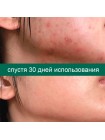 Восстанавливающий крем для проблемной кожи SOME BY MI AHA-BHA-PHA 30 Days Miracle Cream - 60 гр Восстанавливающий крем для проблемной кожи SOME BY MI AHA-BHA-PHA 30 Days Miracle Cream - 60 гр