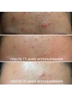 Кислотная сыворотка для проблемной кожи SOME BY MI AHA BHA PHA 30 Days Miracle Serum - 50 мл Кислотная сыворотка для проблемной кожи SOME BY MI AHA BHA PHA 30 Days Miracle Serum - 50 мл