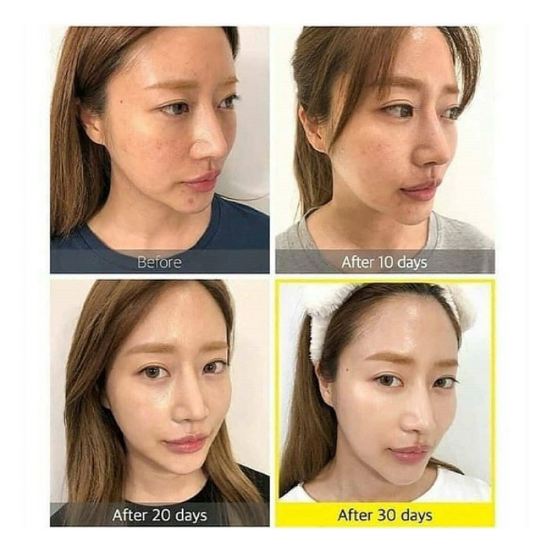 Осветляющая сыворотка с экстрактом юдзу SOME BY MI Yuja Niacin Blemish Care Serum 50 мл