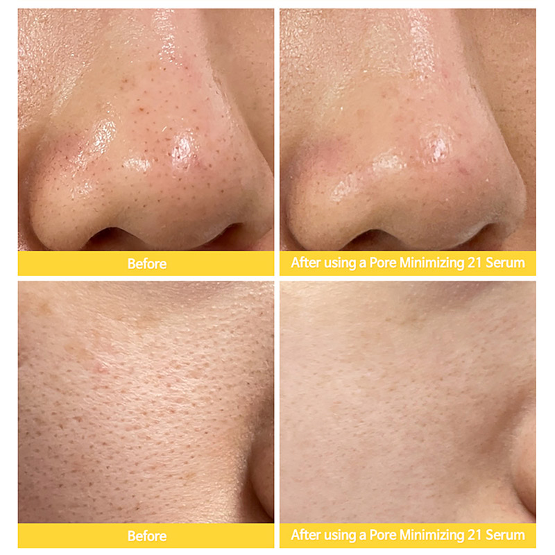 Сыворотка для сужения пор с цинком TIAM Pore Minimizing Serum 40мл