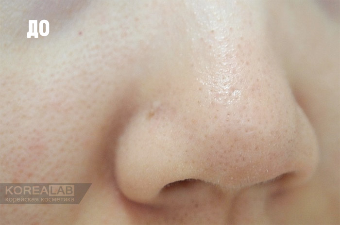 Салфетки для удаления черных точек и камедонов CIRACLE Blackhead Off Cotton Mask