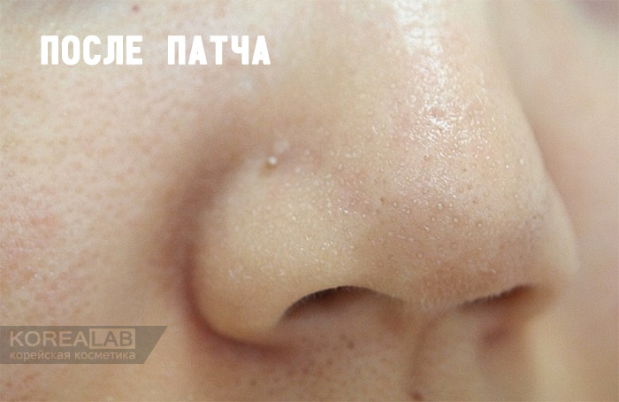 Салфетки для удаления черных точек и камедонов CIRACLE Blackhead Off Cotton Mask