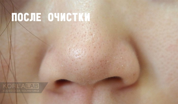 Салфетки для удаления черных точек и камедонов CIRACLE Blackhead Off Cotton Mask
