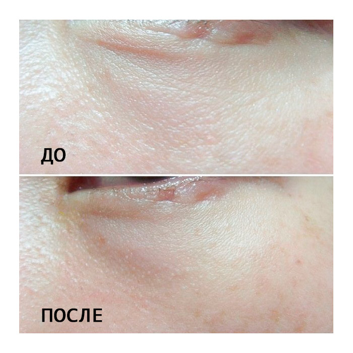 Крем против морщин вокруг глаз PUREBESS Galactomyces 80% Eye Cream