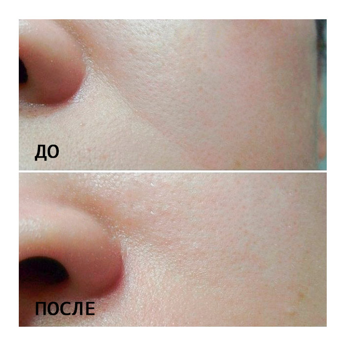 Крем против морщин вокруг глаз PUREBESS Galactomyces 80% Eye Cream