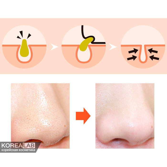 Пластыри от черных точек PUREDERM Nose Pore Strips