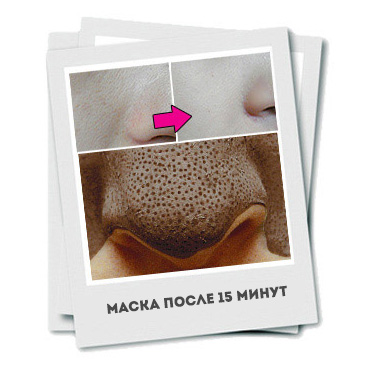 маска для сужения пор snp