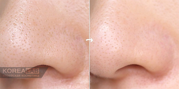 Скраб-стик от черных точек TONY MOLY Tako Pore Blackhead Scrub Stick - 10g