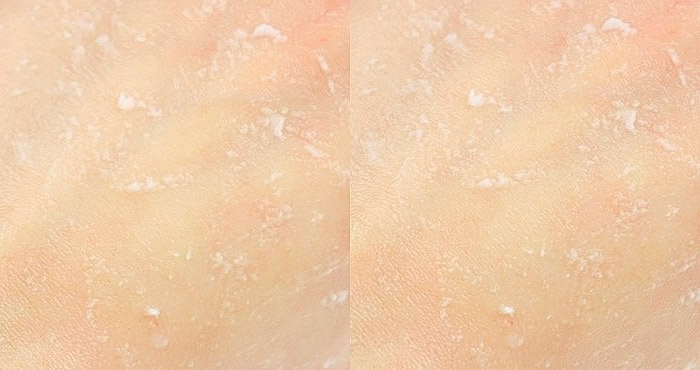 Пилинг-гель для лица с AHA-кислотами ETUDE HOUSE Berry AHA Bright Peel Mild Gel