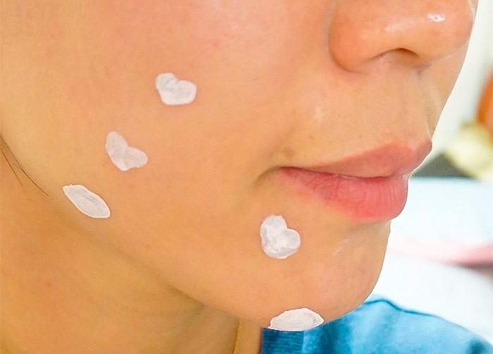 Ночное средство от акне MIZON Acence Blemish Out Pink Spot