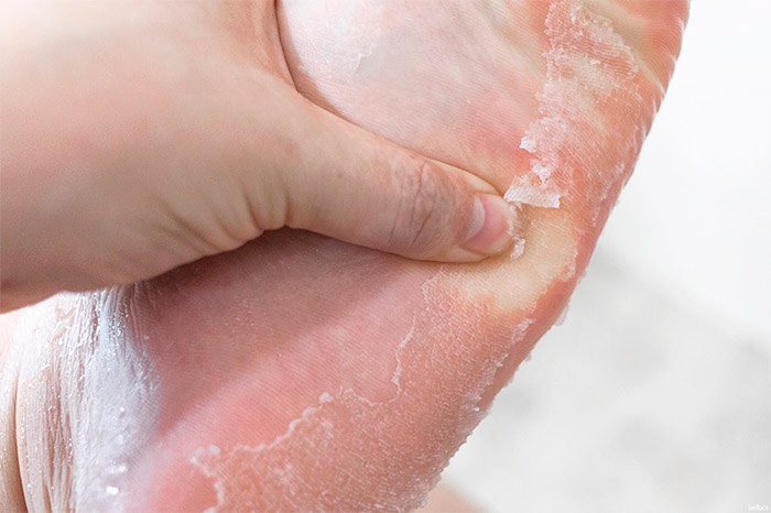 Носочки для пилинга THE SAEM Dear My Foot Power Peeling